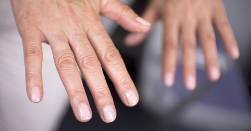 A pair of hands representing Lupus